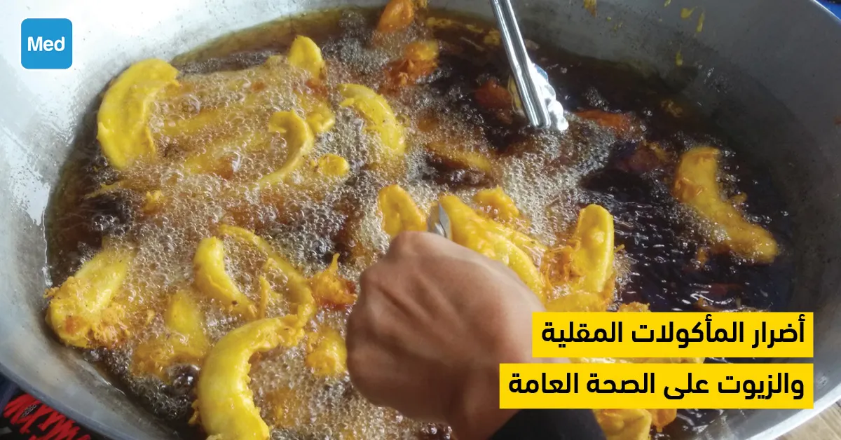 أضرار المأكولات المقلية  والزيوت على الصحة العامة